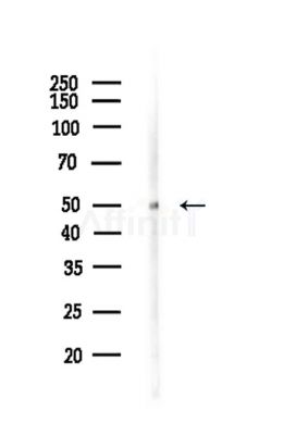 Keratin 23 Antibody - Western blot analysis of lysates from Rat brain, using Keratin 23 Antibody at 1/1000 dilution.
