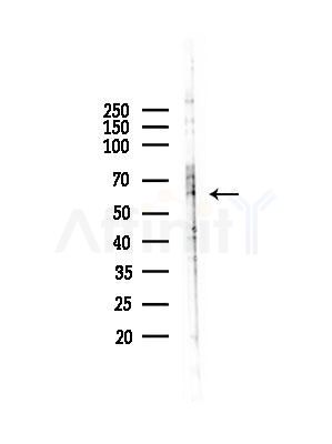 Cytokeratin 9 Antibody - Western blot analysis of lysates from Hela cells(heat-shock,45min treatment), using Cytokeratin 9 Antibody at 1/1000 dilution.