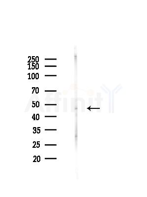 K1H2 Antibody - Western blot analysis of lysates from A375 cells(heat-shock,45min treatment), using K1H2 Antibody at 1/1000 dilution.