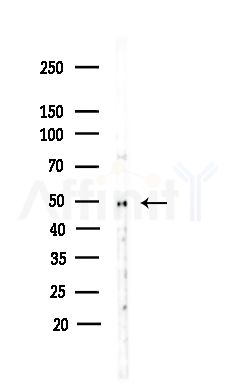 K1H4 Antibody - Western blot analysis of lysates from COLO205 cells(heat-shock,45min treatment), using K1H4 Antibody at 1/1000 dilution.