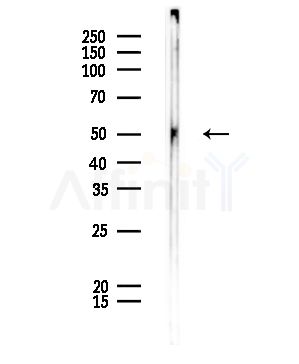 KRT35/37/38 Antibody - Western blot analysis of lysates from Rat lung, using KRT35/37/38 Antibody at 1/1000 dilution.
