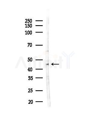 K1HB Antibody - Western blot analysis of lysates from Hela cells(heat-shock,45min treatment), using K1HB Antibody at 1/1000 dilution.