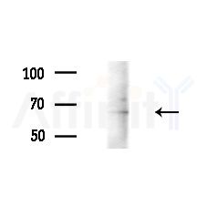 Cytokeratin 2e Antibody - Western blot analysis of extracts from 3T3-L1 cells(heat-shock,45min treatment), using Cytokeratin 2e Antibody at 1/1000 dilution.