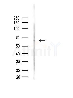 Cytokeratin 2e Antibody - Western blot analysis of lysates from 3T3-L1 cells(heat-shock,45min treatment), using Cytokeratin 2e Antibody at 1/1000 dilution.