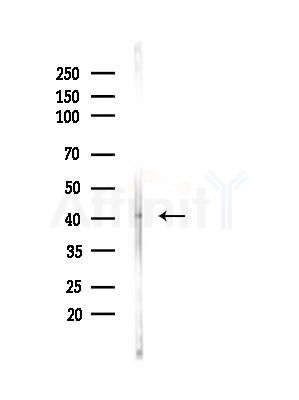 MAGEA10 Antibody - Western blot analysis of lysates from Mouse liver, using MAGEA10 Antibody at 1/1000 dilution.
