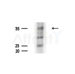 MAGEB1 Antibody - Western blot analysis of extracts from HepG2 cells(LPS, 4h treatment), using MAGEB1 Antibody at 1/1000 dilution.
