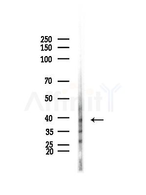 MAGEB1 Antibody - Western blot analysis of lysates from HepG2 cells(LPS, 4h treatment), using MAGEB1 Antibody at 1/1000 dilution.
