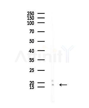 ROBLD3 Antibody - Western blot analysis of lysates from COLO205 cells, using ROBLD3 Antibody at 1/1000 dilution.