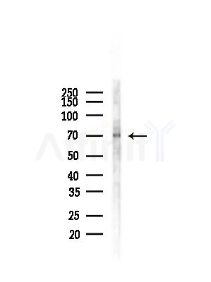 MYLK2 Antibody - Western blot analysis of lysates from Hela cells(heat-shock, 45min treatment), using MYLK2 Antibody at 1/1000 dilution.