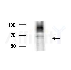 CYB5R4 Antibody - Western blot analysis of lysates from B16F10-LUC cells(LPS,4h treatment), using CYB5R4 Antibody at 1/1000 dilution.