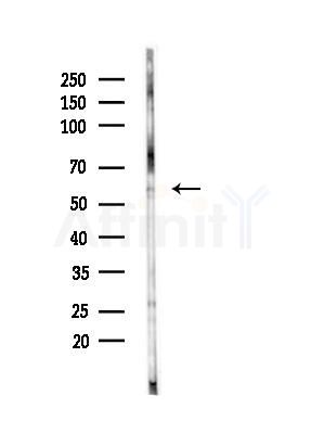 CYB5R4 Antibody - Western blot analysis of lysates from B16F10-LUC cells(LPS,4h treatment), using CYB5R4 Antibody at 1/1000 dilution.