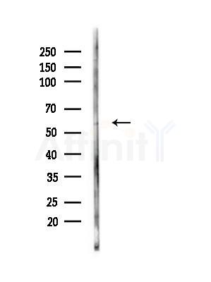 CYB5R4 Antibody - Western blot analysis of lysates from 3T3-L1 cells(heat-shock,45min treatment), using CYB5R4 Antibody at 1/1000 dilution.