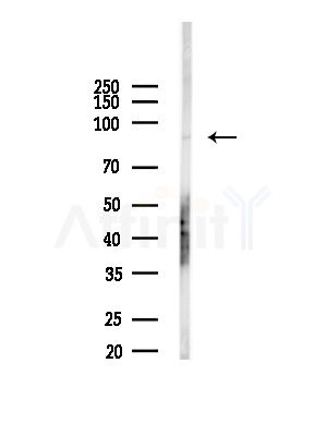 PDCD6IP Antibody - Western blot analysis of lysates from Mouse brain, using PDCD6IP Antibody at 1/1000 dilution.