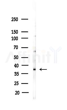 PDCD2L Antibody - Western blot analysis of lysates from COLO205 cells(heat-shock,45min treatment), using PDCD2L Antibody at 1/1000 dilution.