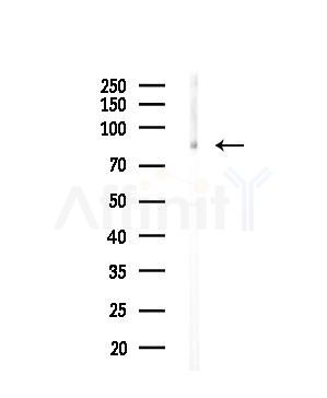 PLCD1 Antibody - Western blot analysis of lysates from COS-7 cells(heat-shock,45min treatment), using PLCD1 Antibody at 1/1000 dilution.