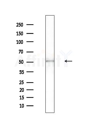 Wnt10b Antibody - Western blot analysis of extracts from B16F10-LUC cells(UV, 30min treatment), using Wnt10b Antibody at 1/1000 dilution.