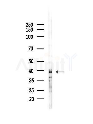 XCR1 Antibody - Western blot analysis of lysates from COLO205 cells(UV,30min treatment), using XCR1 Antibody at 1/1000 dilution.