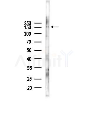 TNIK Antibody - Western blot analysis of lysates from B16F10-LUC cells(starvation,24h treatment), using TNIK Antibody at 1/1000 dilution.