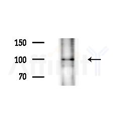 CENPC1 Antibody - Western blot analysis of extracts from B16F10-LUC cells(LPS,4h treatment), using CENPC1 Antibody at 1/1000 dilution.