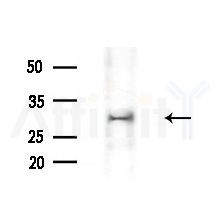 CENPP Antibody - Western blot analysis of extracts from various samples, using CENPP Antibody at 1/1000 dilution.