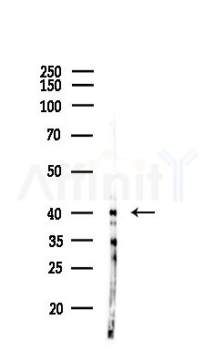 ACAA2 Antibody - Western blot analysis of lysates from LoVo cells(heat-shock,45min treatment), using ACAA2 Antibody at 1/1000 dilution.