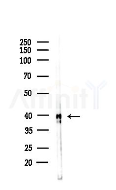 ACAA2 Antibody - Western blot analysis of lysates from Hela cells(LPS,4h treatment), using ACAA2 Antibody at 1/1000 dilution.