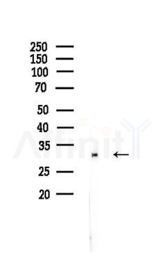 RFC5 Antibody - Western blot analysis of lysates from Rat lung, using RFC5 Antibody at 1/1000 dilution.