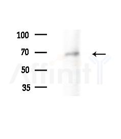 STRN4 Antibody - Western blot analysis of extracts from B16F10-LUC cells(UV, 30min treatment), using STRN4 Antibody at 1/1000 dilution.
