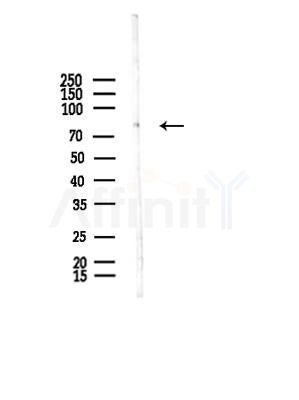 STRN4 Antibody - Western blot analysis of lysates from B16F10-LUC cells(UV,30min treatment), using STRN4 Antibody at 1/1000 dilution.