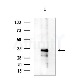 NFKBIL1 Antibody - Western blot analysis of extracts from B16F10-LUC cells(starvation treatment), using NFKBIL1 Antibody at 1/1000 dilution.