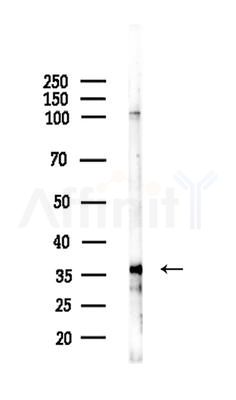NFKBIL1 Antibody - Western blot analysis of lysates from B16F10-LUC cells(starvation treatment), using NFKBIL1 Antibody at 1/1000 dilution.