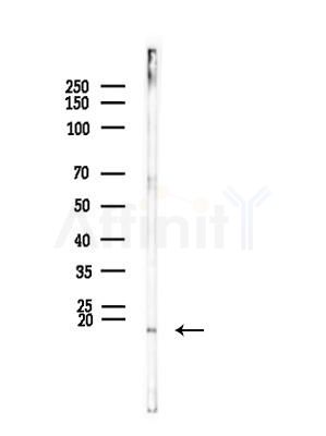 GOLT1B Antibody - Western blot analysis of lysates from Mouse muscle, using GOLT1B Antibody at 1/1000 dilution.