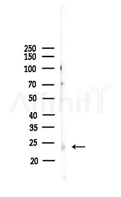 ALKBH7 Antibody - Western blot analysis of lysates from Hela cells(heat-shock,45min treatment), using ALKBH7 Antibody at 1/1000 dilution.
