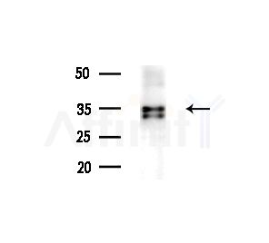 TNIP3 Antibody - Western blot analysis of extracts from MCF7 cells(heat-shock treatment), using TNIP3 Antibody at 1/1000 dilution.