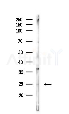 FMR1NB Antibody - Western blot analysis of lysates from Mouse brain, using FMR1NB Antibody at 1/1000 dilution.