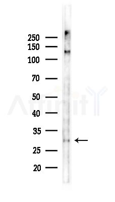 FMR1NB Antibody - Western blot analysis of lysates from Hela cells(heat-shock,45min treatment), using FMR1NB Antibody at 1/1000 dilution.