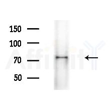 ORC2L Antibody - Western blot analysis of extracts from various samples, using ORC2L Antibody at 1/1000 dilution.