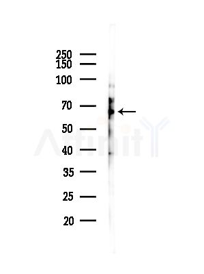 ORC2L Antibody - Western blot analysis of lysates from HepG2 cells(starvation,24h treatment), using ORC2L Antibody at 1/1000 dilution.