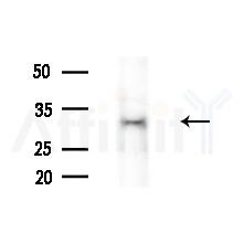 ORC6L Antibody - Western blot analysis of extracts from various samples, using ORC6L Antibody at 1/1000 dilution.