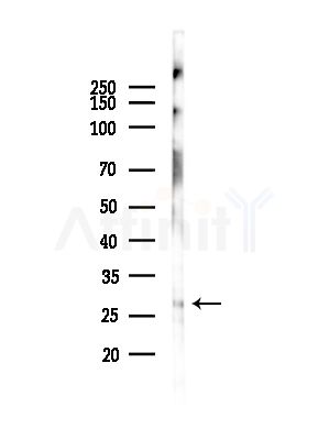ORC6L Antibody - Western blot analysis of lysates from HepG2 cells(starvation,24h treatment), using ORC6L Antibody at 1/1000 dilution.