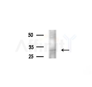 AGPAT1 Antibody - Western blot analysis of extracts from Rat brain, using AGPAT1 Antibody at 1/1000 dilution.