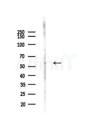 AGPAT7 Antibody - Western blot analysis of lysates from COLO205 cells(UV,30min treatment), using AGPAT7 Antibody at 1/1000 dilution.