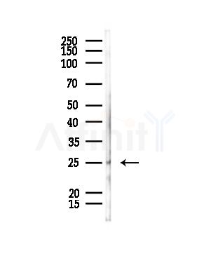 PSMD9 Antibody - Western blot analysis of lysates from Rat liver, using PSMD9 Antibody at 1/1000 dilution.