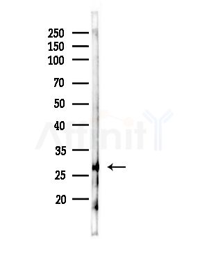 PSMD9 Antibody - Western blot analysis of lysates from RAW264.