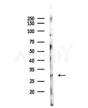 MRPS18B Antibody - Western blot analysis of lysates from COLO205 cells(UV,30min treatment), using MRPS18B Antibody at 1/1000 dilution.
