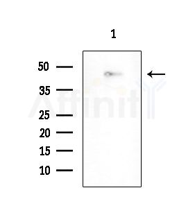 MRPS31 Antibody - Western blot analysis of extracts from COLO205 cells, using MRPS31 Antibody at 1/1000 dilution.