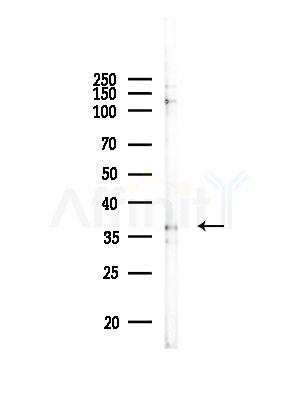 MRPL1 Antibody - Western blot analysis of lysates from RAW264.