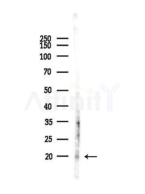 MRPL17 Antibody - Western blot analysis of lysates from MDA-MB-231 cells(heat-shock,45min treatment), using MRPL17 Antibody at 1/1000 dilution.