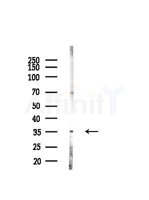 MRPL19 Antibody - Western blot analysis of lysates from Hela cells(starvation,24h treatment), using MRPL19 Antibody at 1/1000 dilution.
