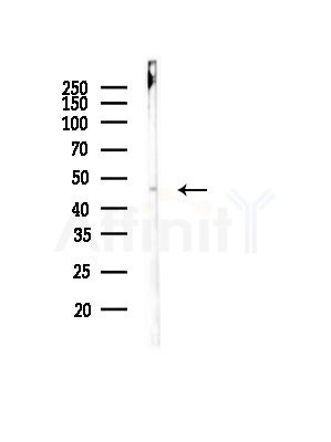 MRPL37 Antibody - Western blot analysis of lysates from EC304 cells(starvation,24h treatment), using MRPL37 Antibody at 1/1000 dilution.